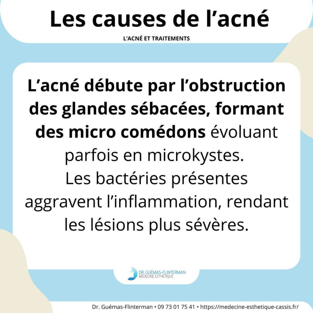 causes acne