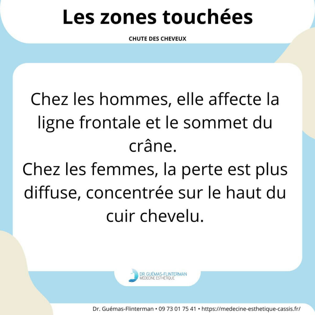 zones chute cheveux