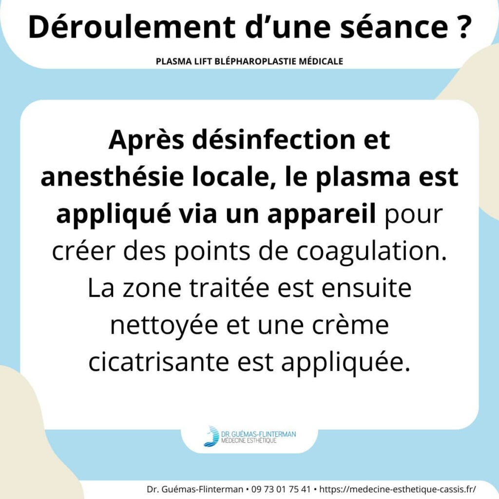 deroulement seance Plasma lift