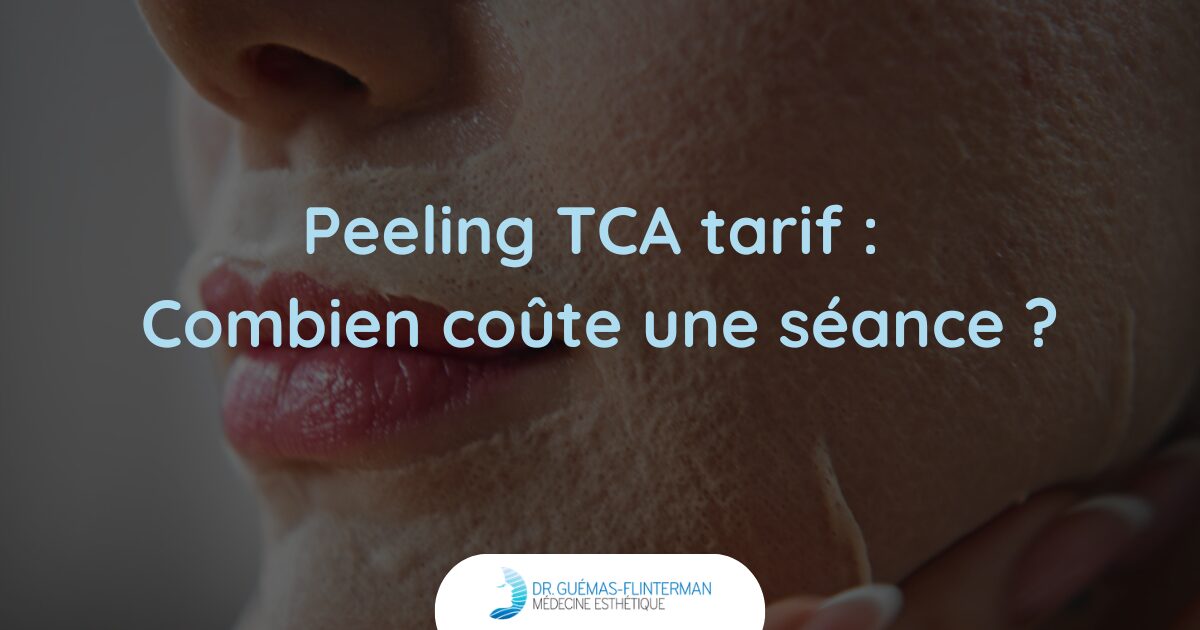 peeling tca tarif